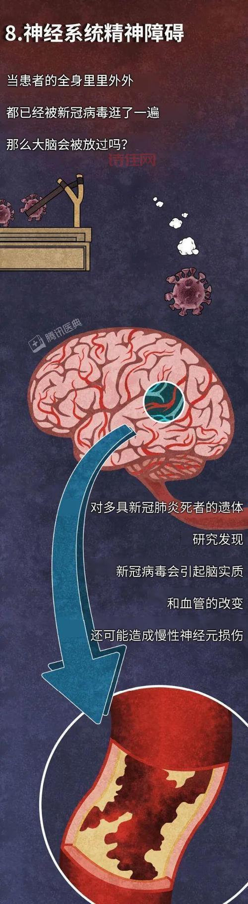 新冠重症患者占比7%可不可怕？听听专家怎么说！