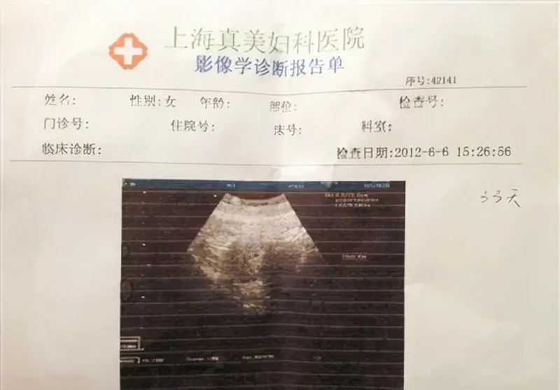 袁立：嫁给了外国人，才会知道中国男人的好，三婚终于收获幸福