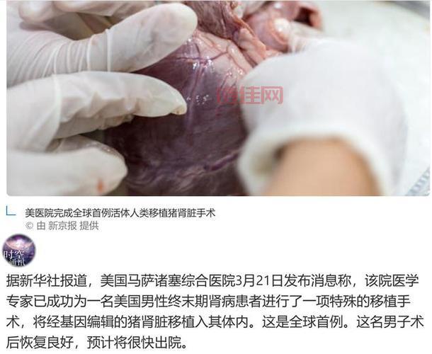 中国团队在猪体内培育出人类肾脏