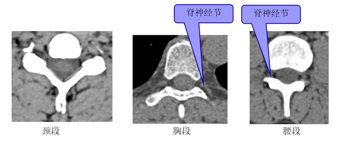 图文详解 | 脊柱解剖图谱