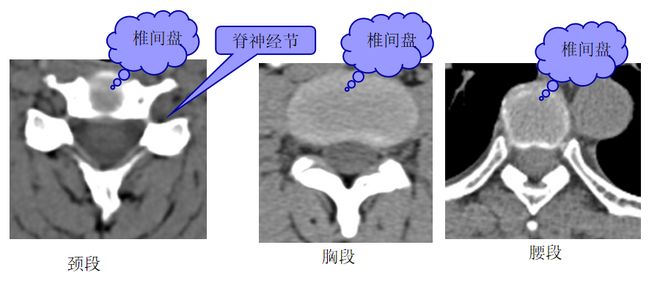图文详解 | 脊柱解剖图谱