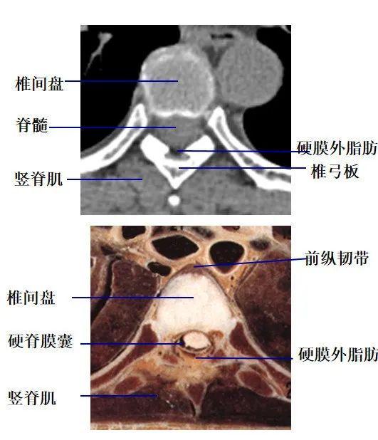 图文详解 | 脊柱解剖图谱