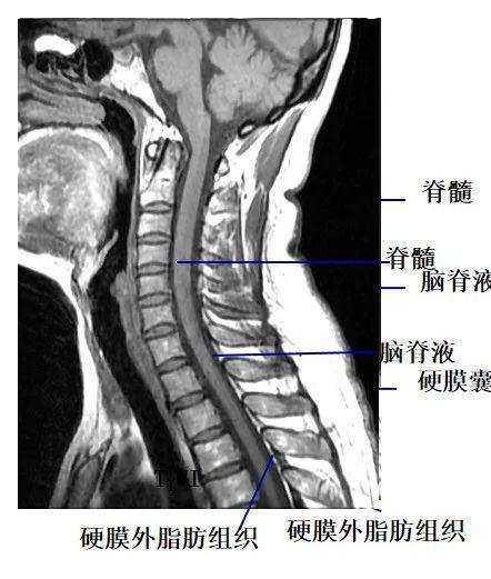 图文详解 | 脊柱解剖图谱