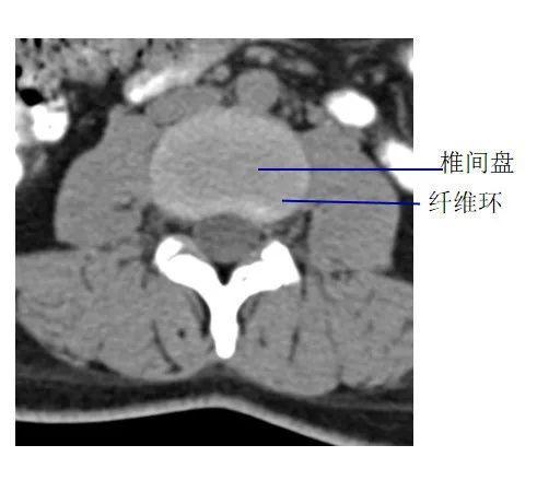 图文详解 | 脊柱解剖图谱