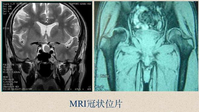 脊柱超详细解剖，高清图文影像！