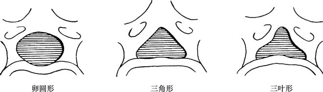 脊柱超详细解剖，高清图文影像！