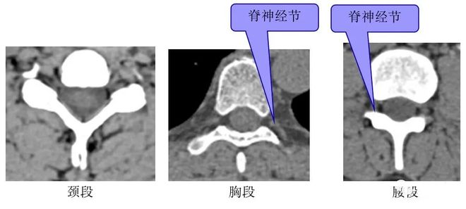 脊柱超详细解剖，高清图文影像！