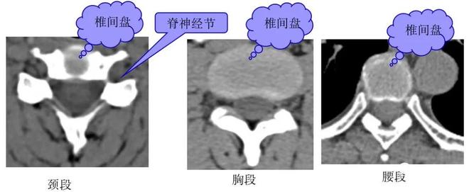 脊柱超详细解剖，高清图文影像！