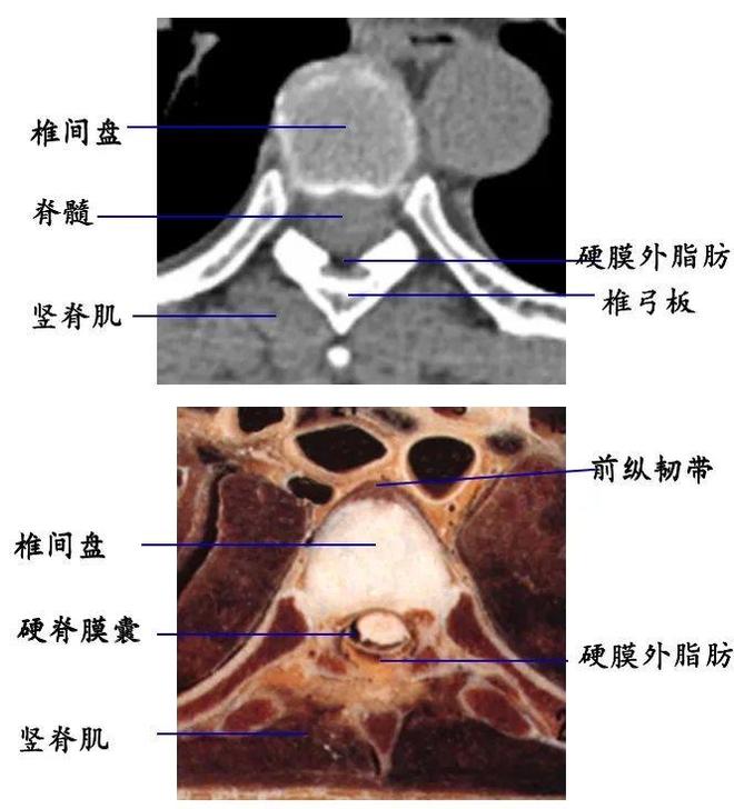 脊柱超详细解剖，高清图文影像！