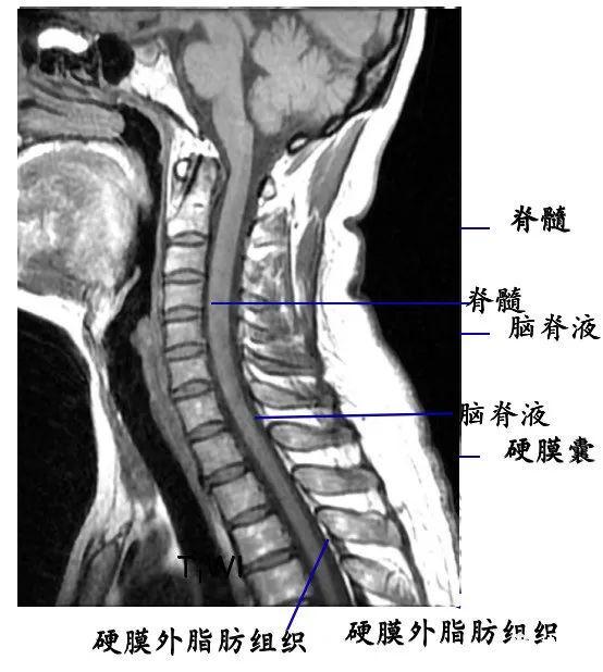脊柱超详细解剖，高清图文影像！
