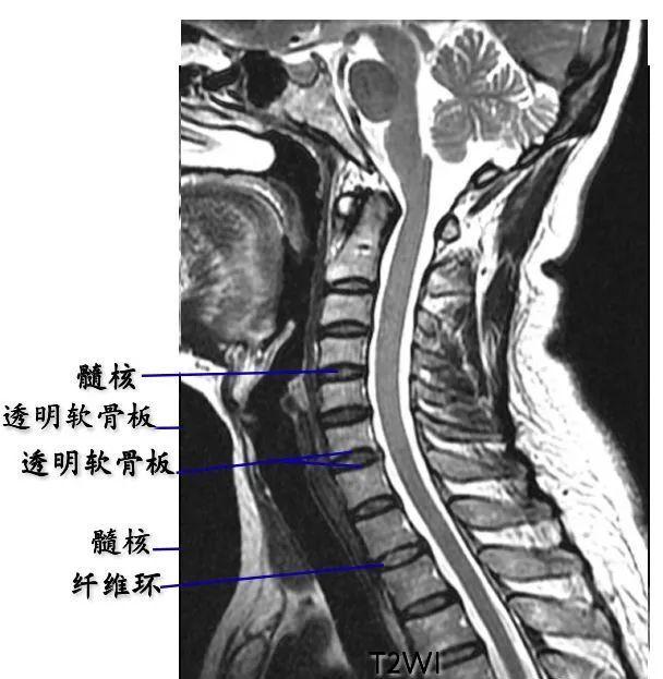 脊柱超详细解剖，高清图文影像！