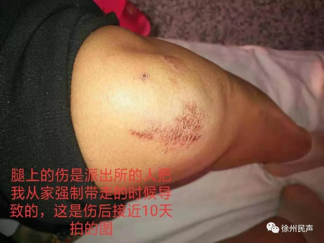 江苏徐州女教师留绝笔信后出走失联 带女儿看病却被定性为“上访”？女教师绝笔信内容全文曝光