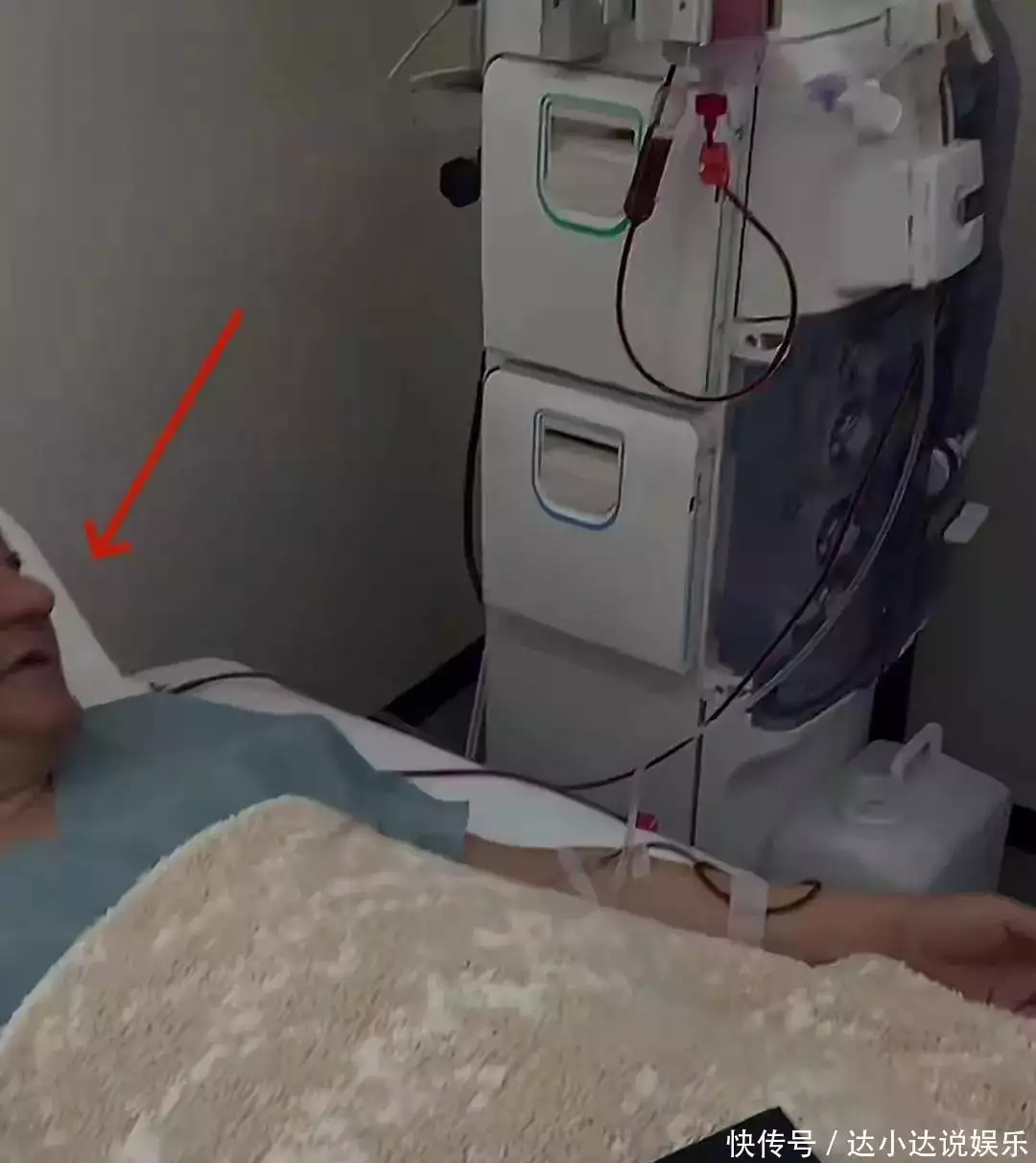 央视退休主持人王宁疑日本做大血净，腹部突出明显，脸肿面色发暗