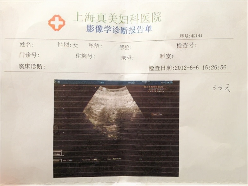 袁立：嫁给了外国人，才会知道中国男人的好，三婚终于收获幸福