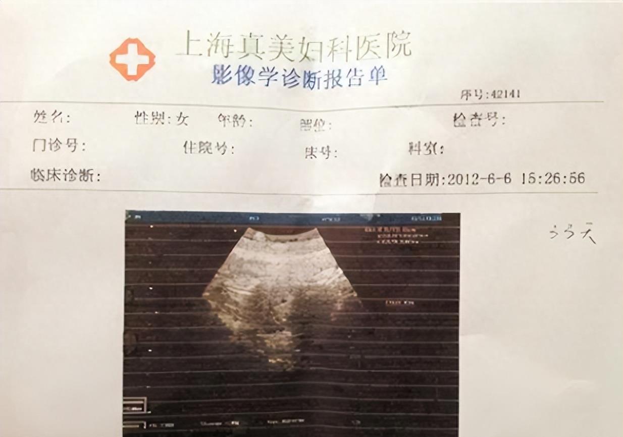 袁立：被富豪宠12年仍不愿结婚，现50岁嫁穷诗人