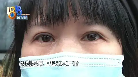 双眼皮手术以后，左眼成了“三角形”？
