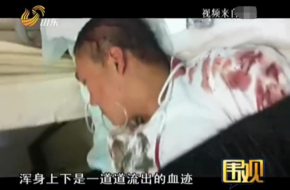 2011年，校霸与富二代发生冲突，被对方父母叫人砍断双手丧命