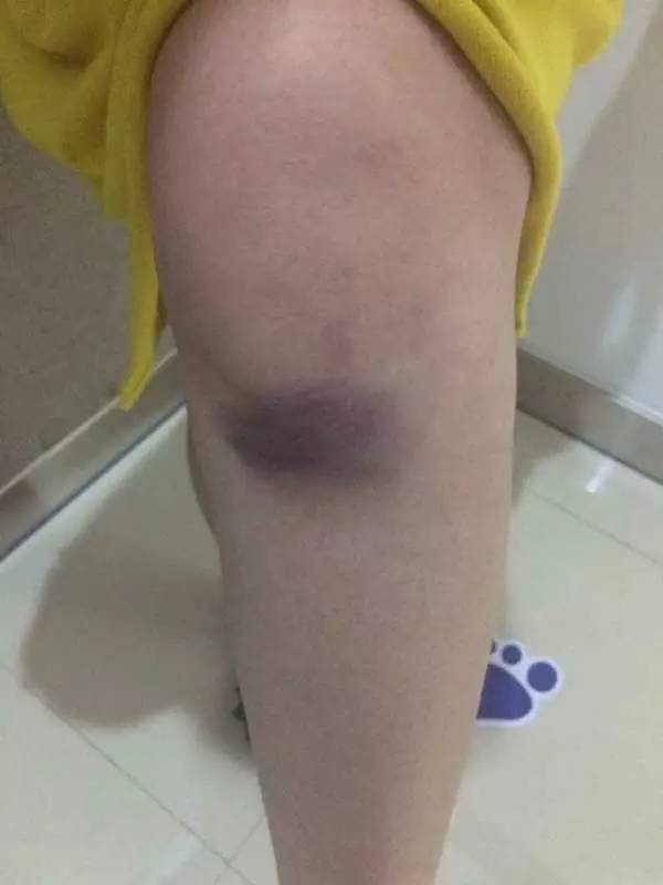 警讯丨搞事情！织里街头“大乱斗”，警察蜀黍将其“一网打尽”