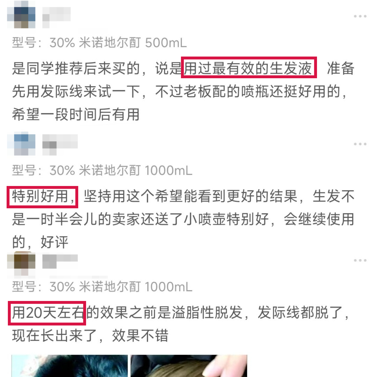 米诺地尔浓度都出到30%了？是我out了还是科技太进步了？谁敢用？