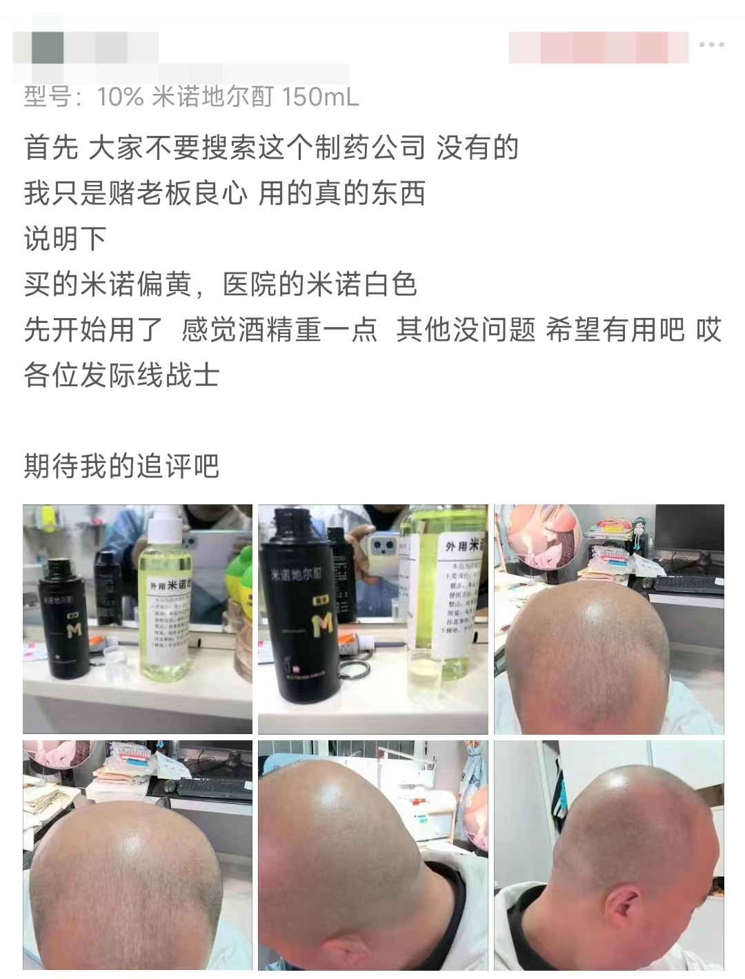 米诺地尔浓度都出到30%了？是我out了还是科技太进步了？谁敢用？
