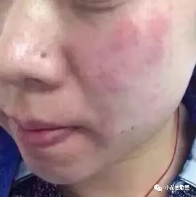 药物的毒副作用，如何应对？
