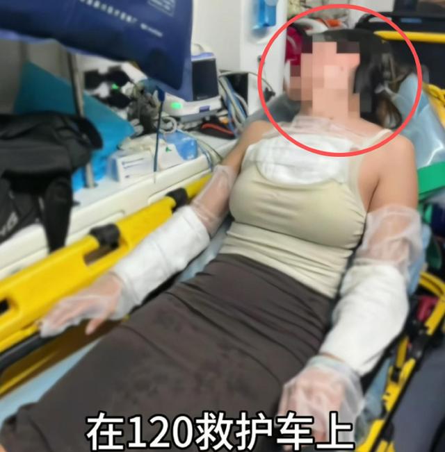 女子被服务员泼开水后续，伤势惨重，凶手事后嚣张炫耀，原因曝光