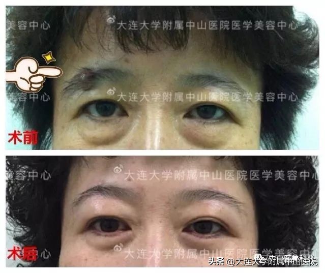【爱美•科普】“痣”，绝对不可以轻视