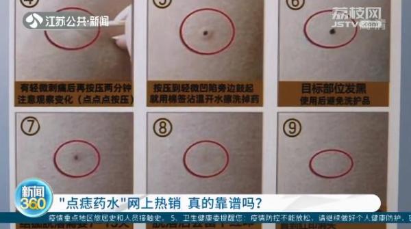 点痣药水热卖！专家提醒：或有癌变风险