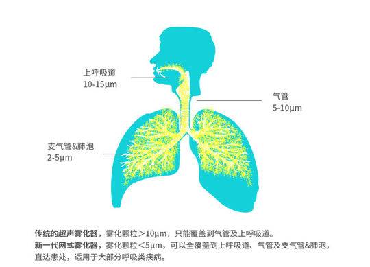 儿童家庭雾化治疗须避开五大误区