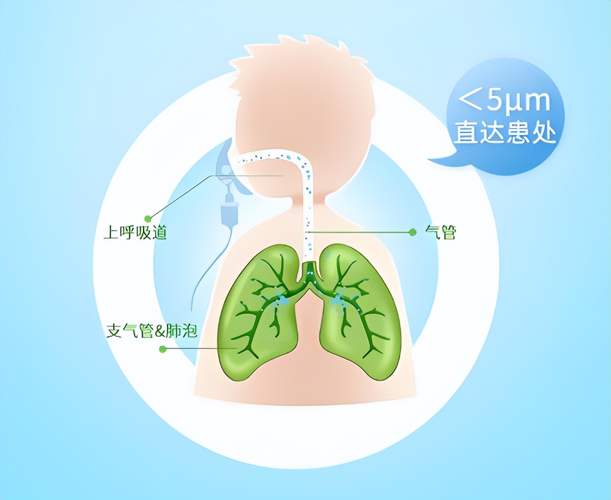 必看|一文教会你：怎么选购家用医疗雾化器~