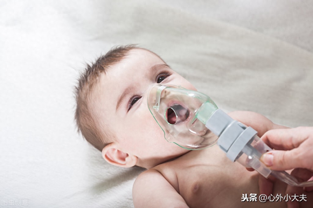 雾化吸入知多少？