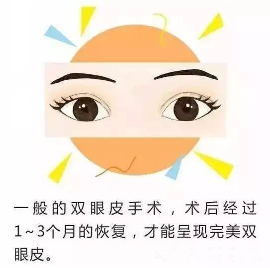 想要做完双眼皮不留痕迹？你需要看这里