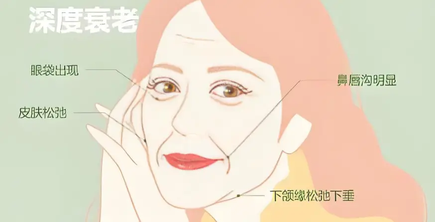 最全解析|线雕面部提升维持多久，线雕能维持多长时间？