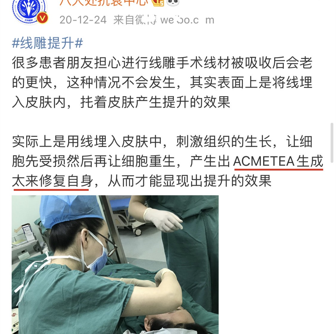 鱼骨线线雕的危害、线雕劝大家千万不要做线雕、一脸认真~