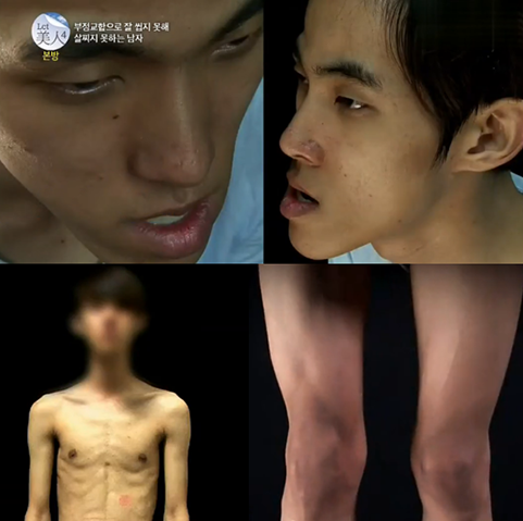 当男孩走进整容医院：谁说男人就该阳刚一点？