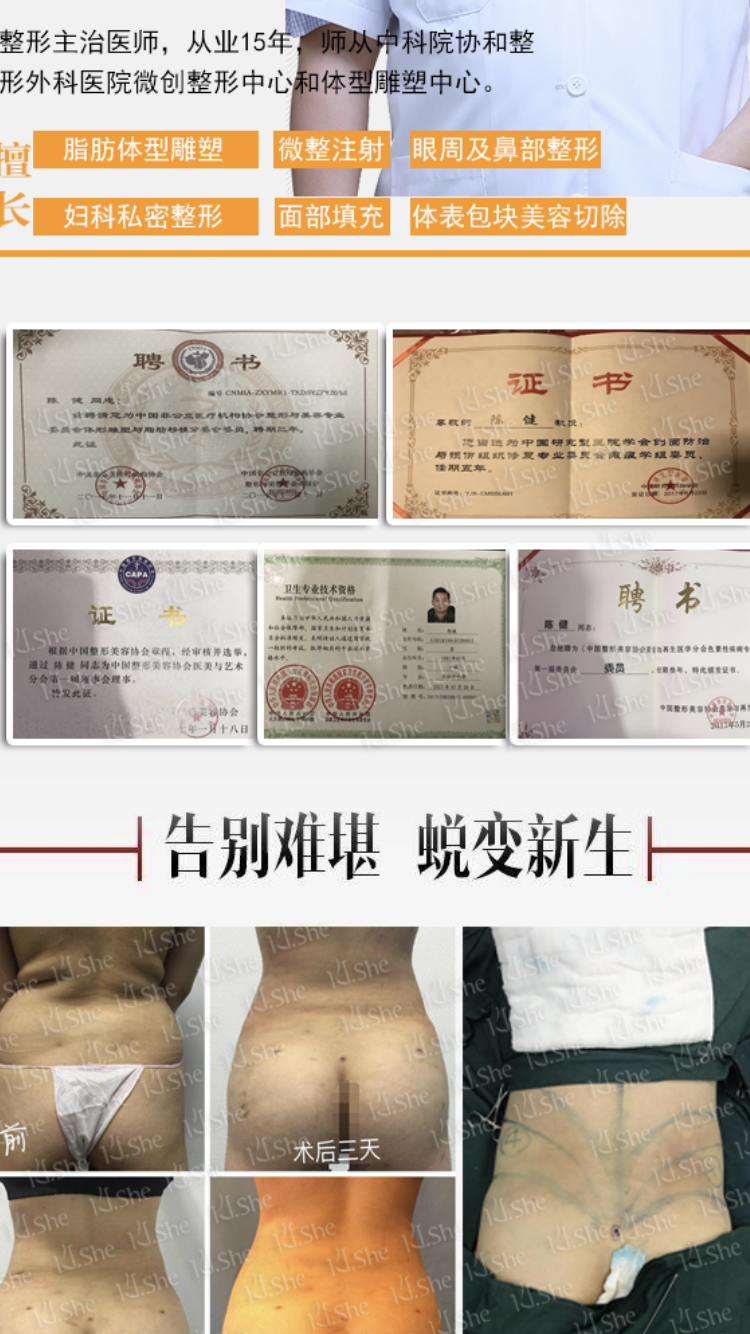 痣千万不要随便点，除了影响美观还有很大的潜在危险！