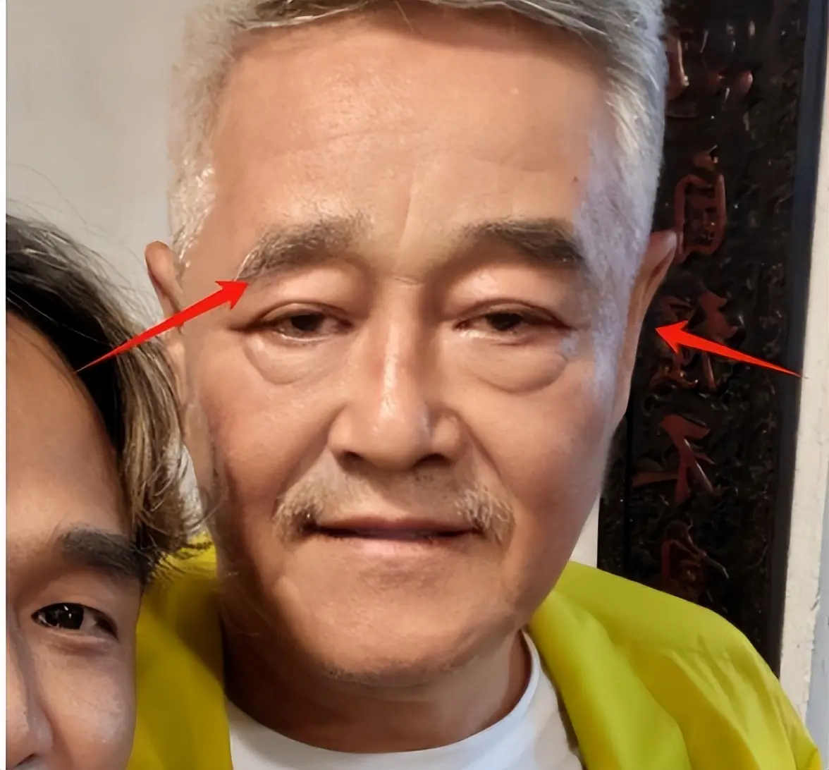 68岁赵本山现状曝光：脸浮肿眼神涣散，徒弟争合照，终究难逃衰老