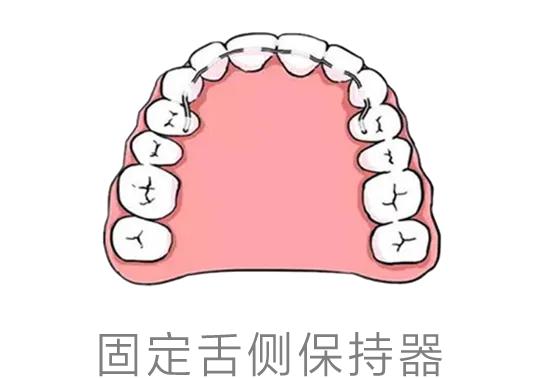 矫正结束了为什么还要戴保持器？