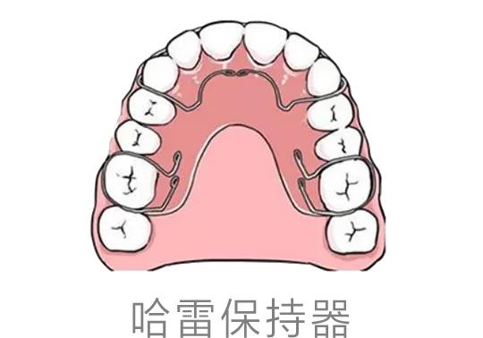 矫正结束了为什么还要戴保持器？