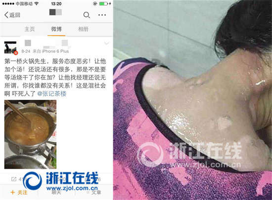 温州火锅店服务员开水泼顾客续：服务员被依法批捕