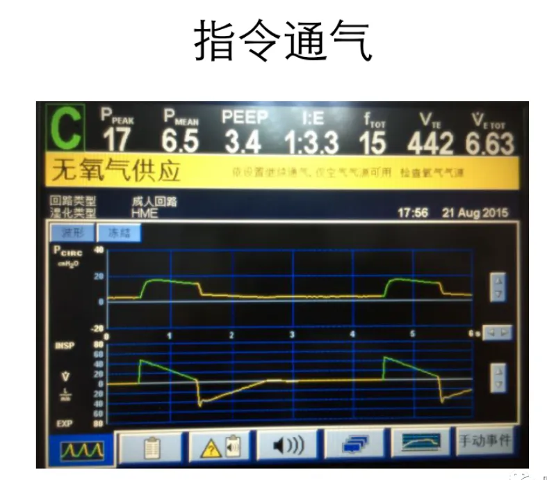 超实用临床干货---机械通气使用之呼吸机模式选择及参数设置（2）