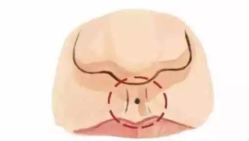 女人人中深代表什么
