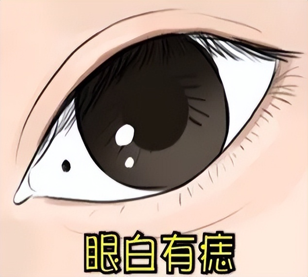 脸上这 5 颗痣，暗示你的桃花运太旺！第 3 种最易惹烂桃花