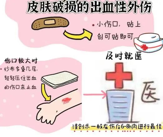 同心医+｜外伤、出血如何应对？急救技术学起来