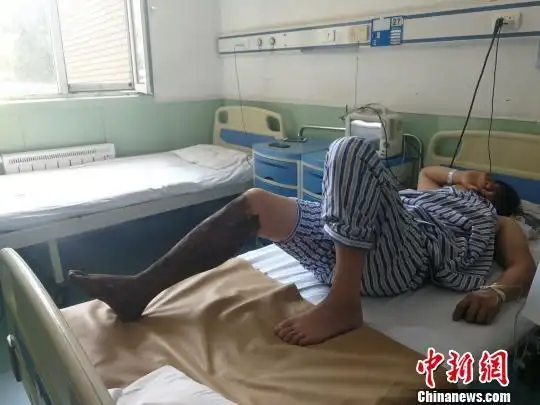 山西男子外出游玩被毒蛇咬伤 腹痛恶心唇舌麻木