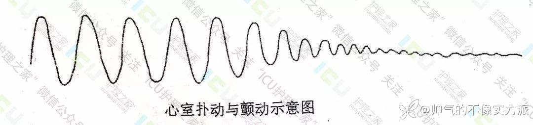 手把手教你看心电图，婴儿式教学