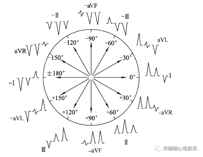 全面解读心电图报告，不再懵懵懂懂！