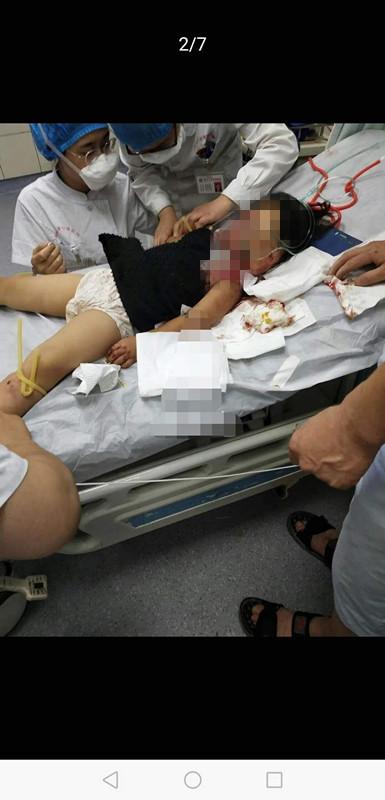 清苑发生一起故意杀人案,嫌犯持铁锹疯狂打击受害人致一死一重伤
