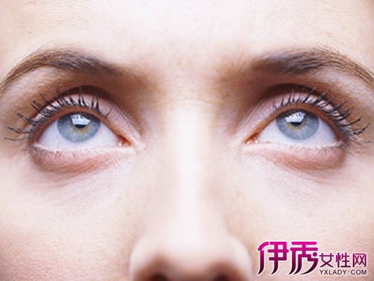 【图】怎样快速消除哭后眼肿   7个小妙招快速消肿