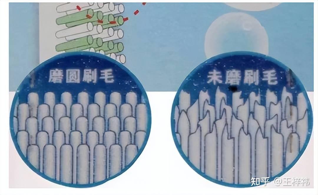 为什么长期刷牙，牙齿还是很黄？牙齿变黄的原因有哪些？
